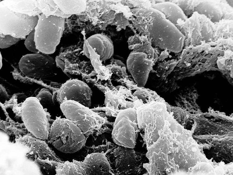 Imagem de microscópio da bactéria que provoca a peste bubônica 
