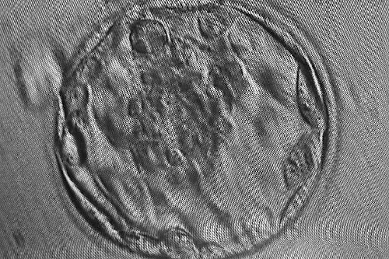 A human blastocyst, day 5 of conception