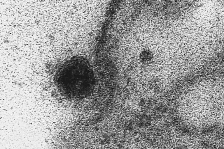 Imagem de microscopia mostra à esquerda o Sars-Cov-2, o novo coronavírus, atacando a membrana de uma célula.