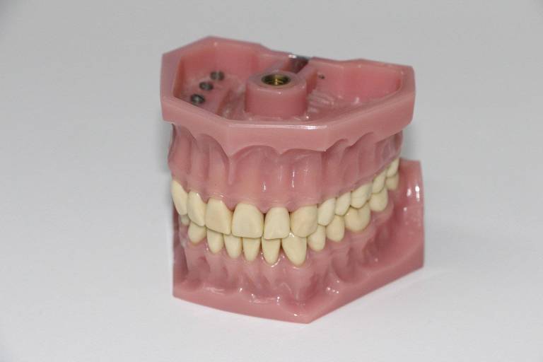Molde de dentadura num fundo branco