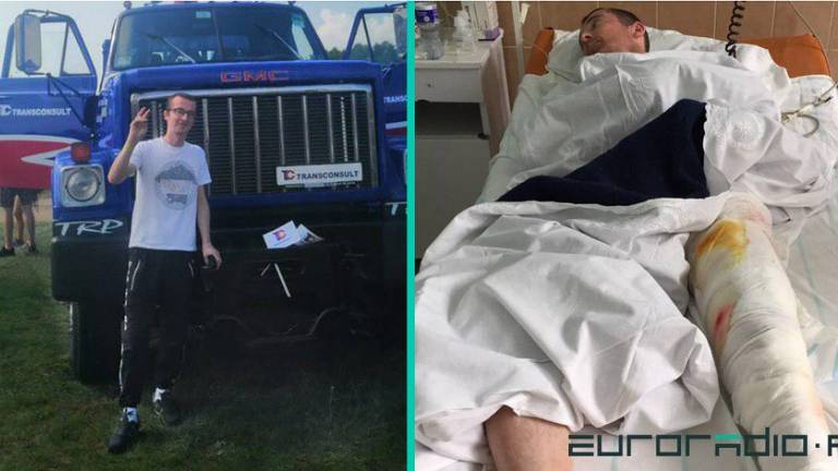 Homem faz sinal de positivo em frente a camiinhão azul/homem com perna enfaixada em cama de hospital
