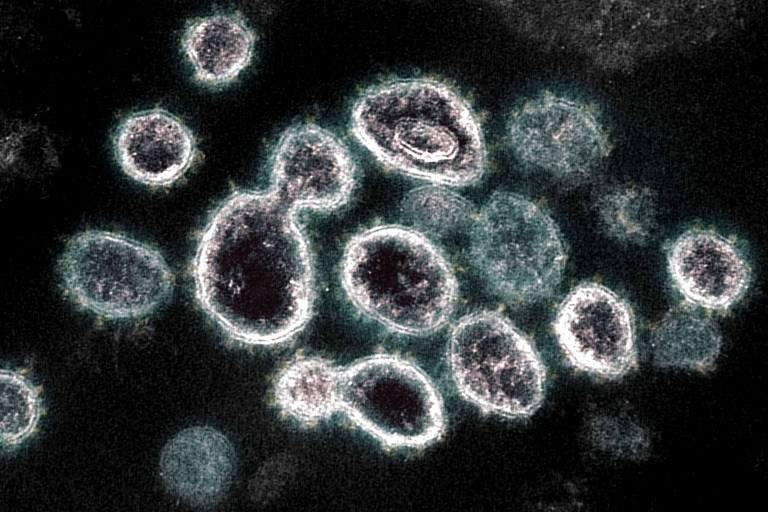 Imagem de microscópio mostra SARS-CoV-2, o vírus que causa o Covid-19