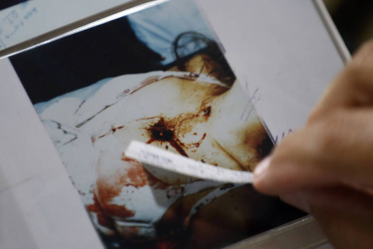 Foto mostra o orifício de entrada do projétil no peito de Suzana Marcolino. Professor de Medicina Legal George Sanguinetti defende a tese do duplo homicídio 