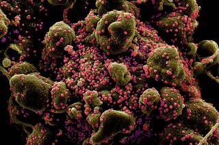 FILE PHOTO: Colorized scanning electron micrograph of an apoptotic cell heavily infected with SARS-COV-2 virus particles, also known as novel coronavirus