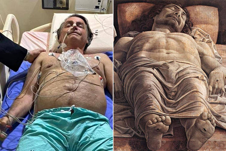 O presidente Jair Bolsonaro em hospital; ao lado, "Cristo Morto", de Mantegna