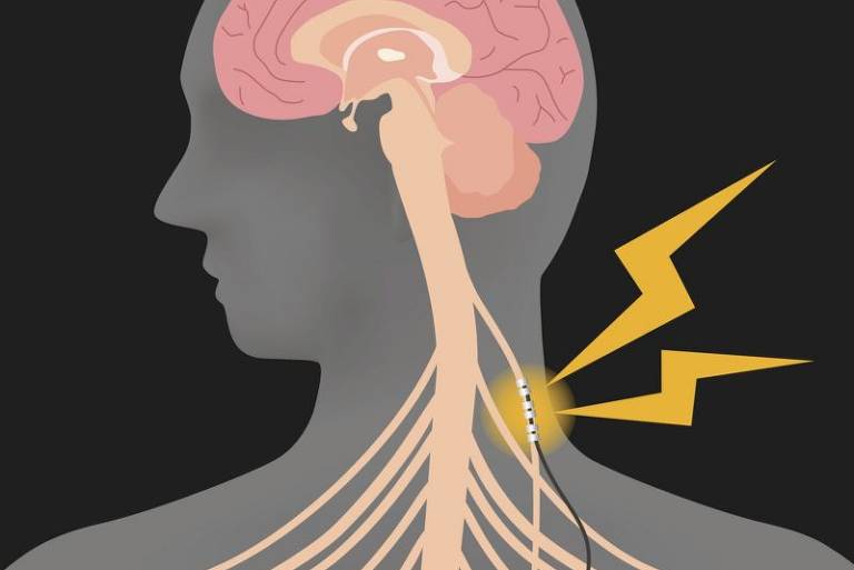 O que é o nervo vago e como ele pode ajudar a reduzir o estresse