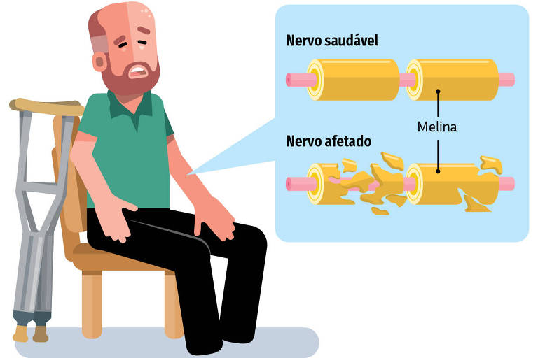 COMPLICACÃO NEUROLÓGICA PÓS-VACINA CONTRA COVID-19: Síndrome da