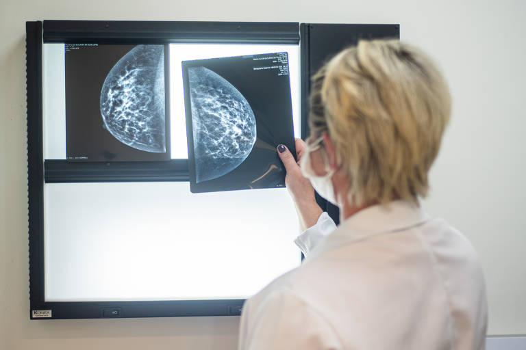 Técnica em mamografia analisando imagem de exame