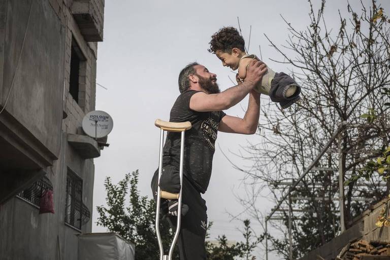 Foto comovente de pai e filho feridos na guerra síria vence prêmio internacional