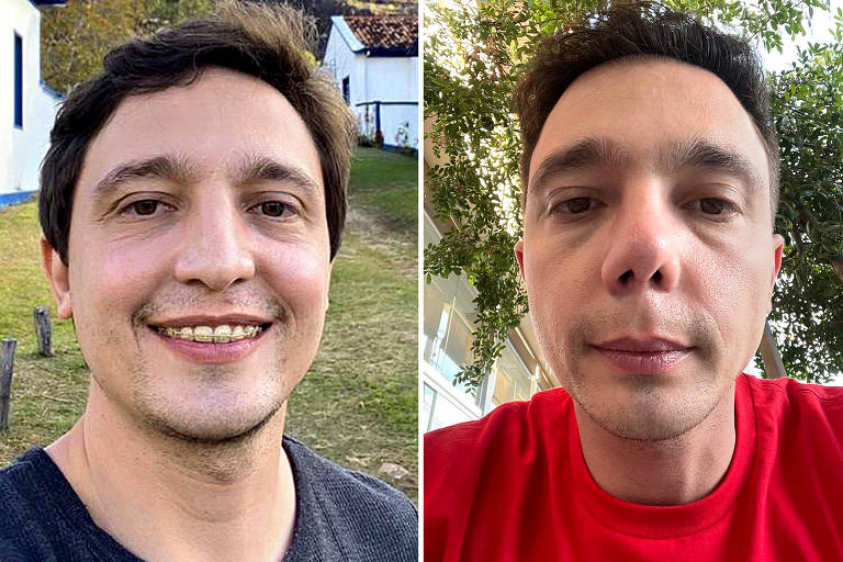 Homem em duas fotos de antes e depois em que aparece com o nariz torto 