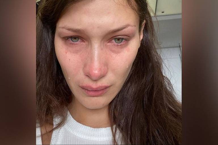 Bella Hadid publicou diversas fotos chorando ao tratar de problemas de saúde mental