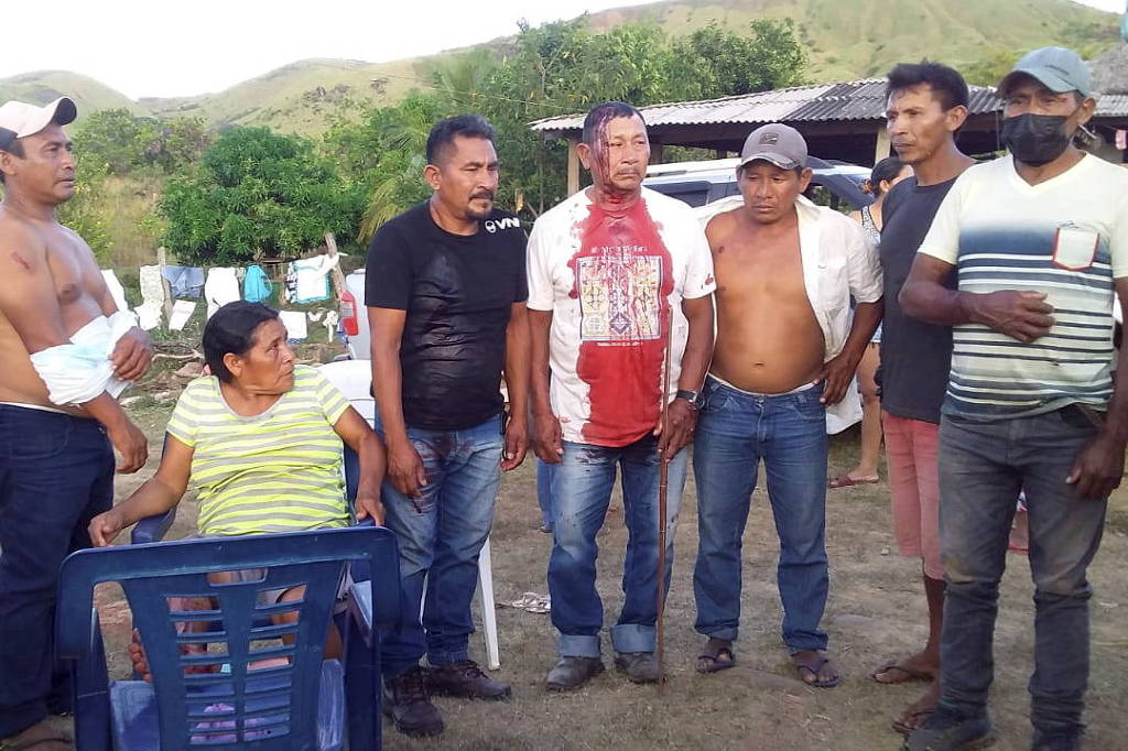 Liderança do povo macuxi, identificado como José de Lima, com sangramento na cabeça após ação da Polícia Militar