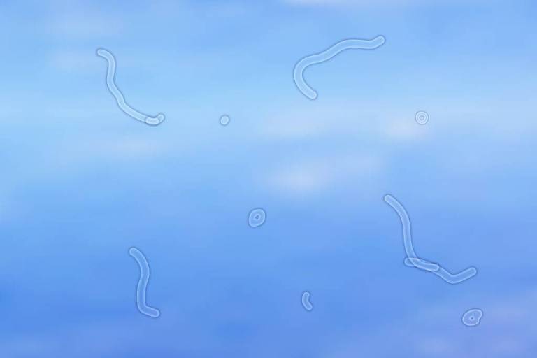 Foto mostra céu azul desfocado ao fundo e moscas volantes na frente. Elas são pequenas manchas semitransparentes com o formato de minhocas, apenas com os contornos mais escuros e definidos