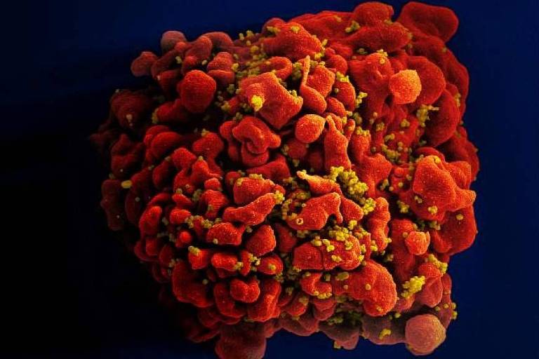 Imagem de uma célula humana infectada com o vírus HIV, feita pelo Instituto Nacional de Saúde, dos Estados Unidos