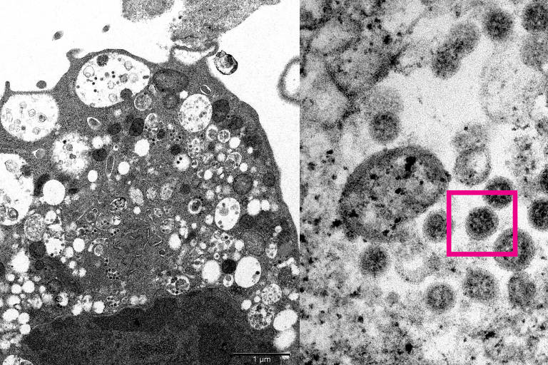  Imagem da variante ômicron do coronavírus vista com um microscópio