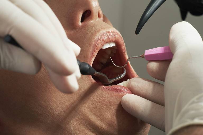 Estado de SP registra recorde de usuários de planos odontológicos em novembro