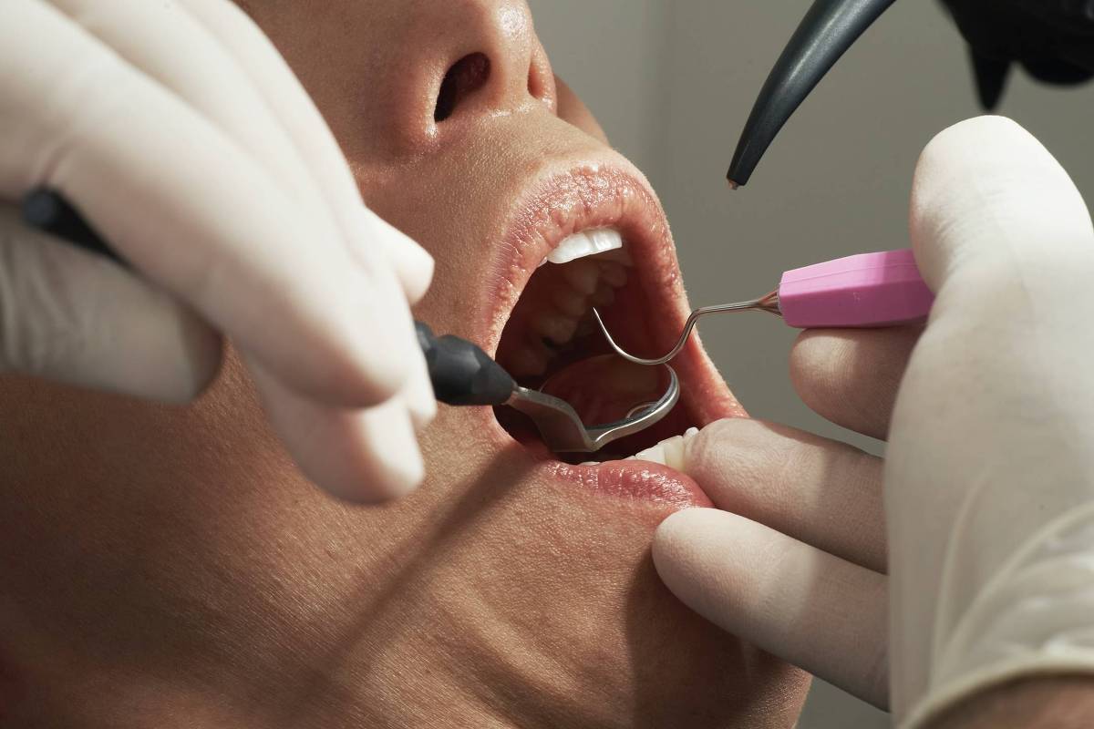 SP set the record for dental plan users – 01/19/2023 – Mônica Bergamo