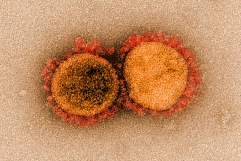 Imagem de microscópio eletrônico do vírus Sars-Cov-2, o novo coronavírus, que provoca a Covid-19