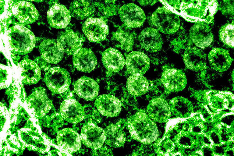 Imagem em microscópio eletrônico mostra os coronavírus que provocam a Covid-19