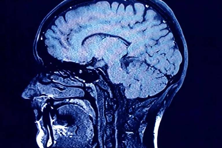 Imagem de tomografia um cérebro humano
