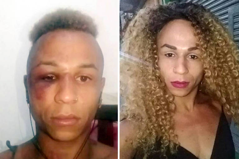 Imagem divida em dois quadros mostra, à esquerda, mulher trans com ferimentos no rosto, à direita, antes de ser agredida