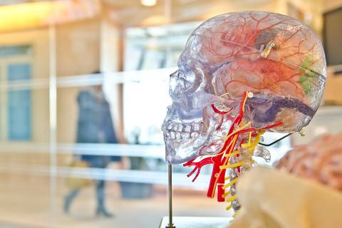 O que é aneurisma - simulação do crânio humano