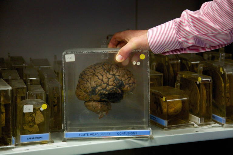 Pedaços de cérebros preservados na universidade Rainha Elizabeth, na Inglaterra