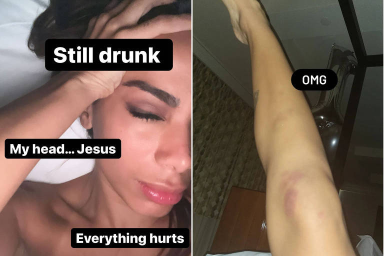 Anitta posta resultado de sua noite de aniversário