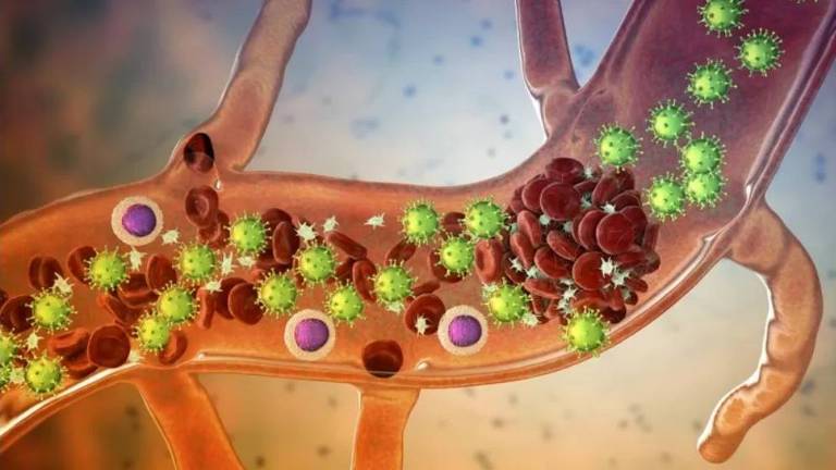 Coronavírus provoca trombose em artéria