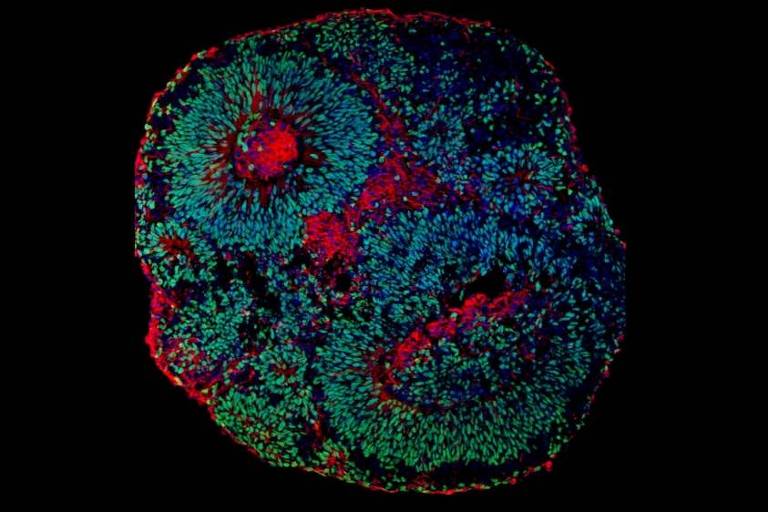 Imagem de microscopia mostrando o aspecto de um organoide cerebral derivado de células humanas. As células em verde são os progenitores de neurônios e as células em vermelho são os neurônios 