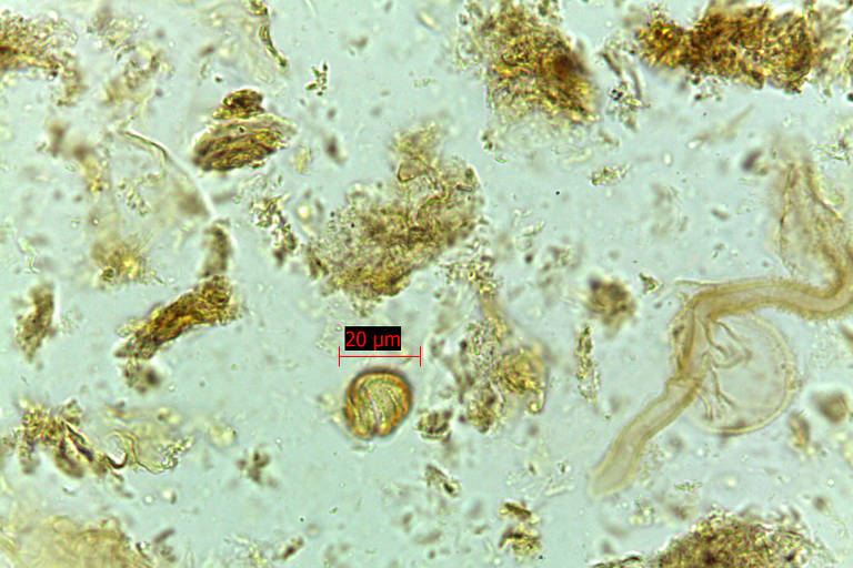 Pólen Eriocaulon encontrada na cratera de Colônia, área circular com 3,6 quilômetros de diâmetro formada entre 30 milhões e 5 milhões de anos atrás no extremo sul da capital paulista, no bairro de Vargem Grande, no distrito de Parelheiros