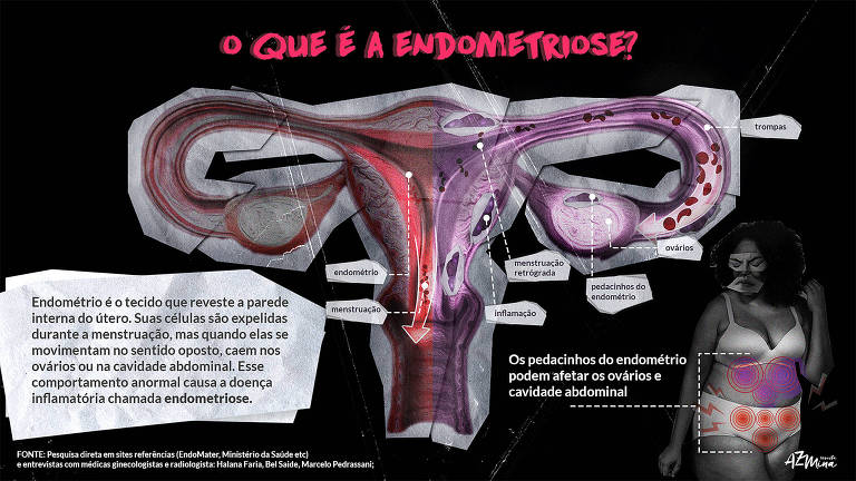 Cólica menstrual fora do ciclo: entenda os motivos