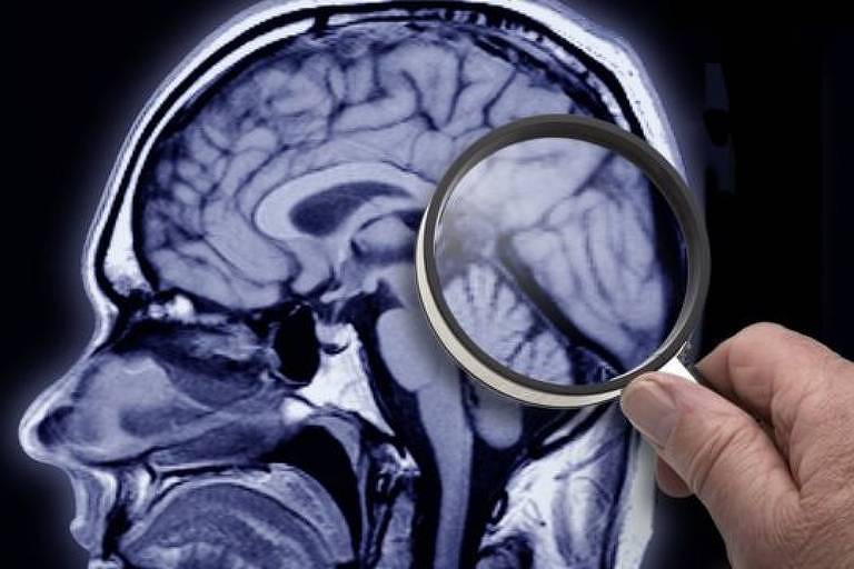 Imagem mostra uma mão segurando uma lupa sobre a ilustração de um cérebro humano