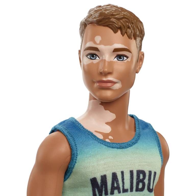 Barbie com síndrome de Down, cadeira de rodas e vitiligo: os