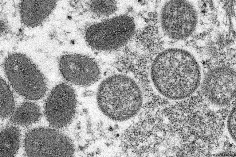 Imagem de microscópio mostra vírus da varíola dos macacos