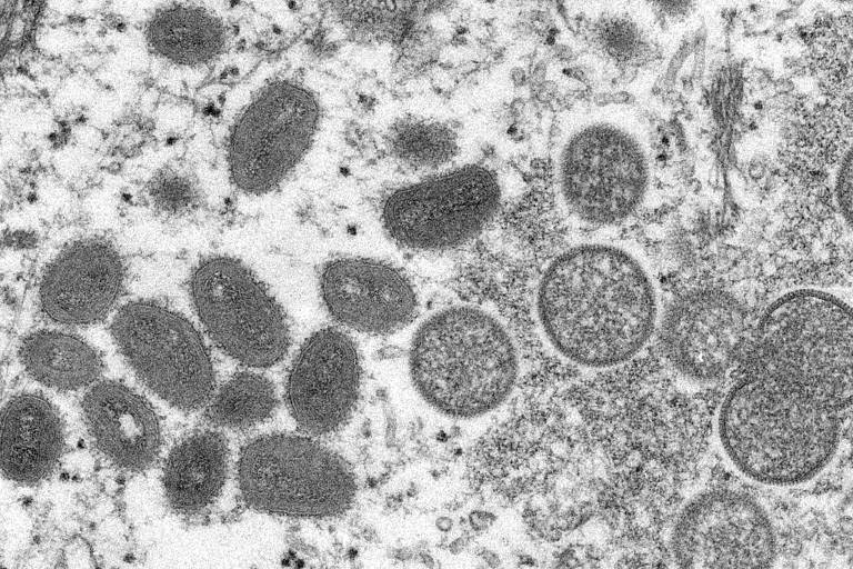 Imagem de microscópio eletrônico dos vírus da varíola dos macacos numa amostra de pele humana