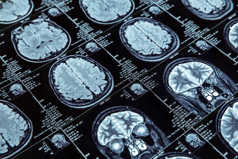 Imagens de ressonância magnética do cérebro humano