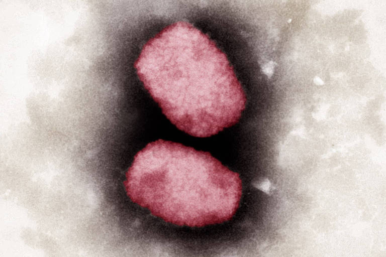 Varíola dos macacos: o que se sabe sobre a mutação do vírus