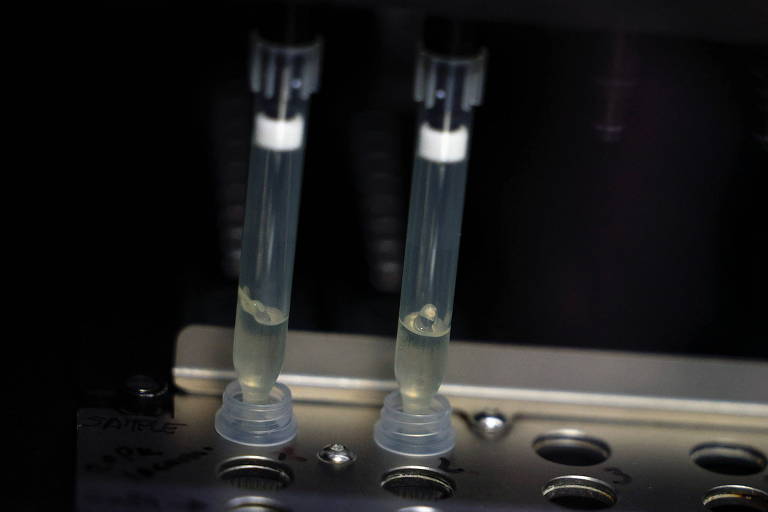 Duas amostras de casos suspeitos de varíola dos macacos passam por testes em laboratório do Hospital La Paz, em Madri (ESP)