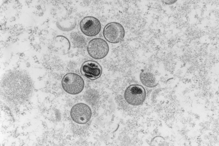 OMS teme que vírus da varíola dos macacos se instale em países não endêmicos