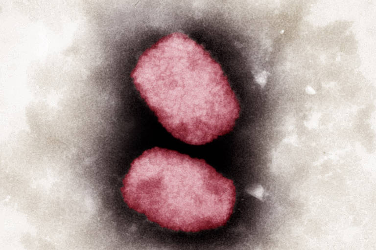 O monkeypox é o vírus que causa a varíola dos macacos. Na imagem, uma imagem do patógeno capturado por microscópio