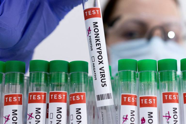 OMS pede ação urgente contra varíola dos macacos na Europa