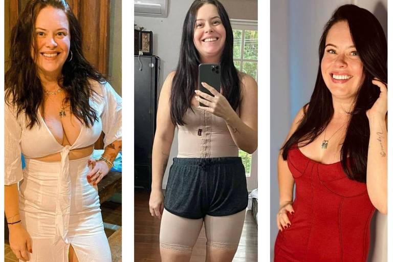 Mari Bridi mostra antes e depois de cirurgias pelo corpo