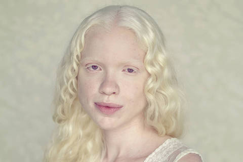 Fabiane, albina fotografada pelo mineiro Gustavo Lacerda, 44, para o livro 