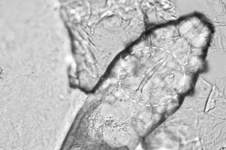 Imagem de microscópio mostra um ácaro