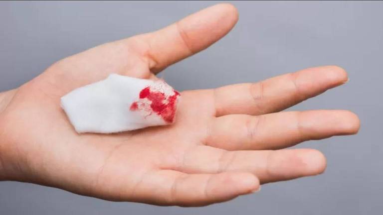 Mão aberta com um pedaço de papel higiênico manchado de sangue