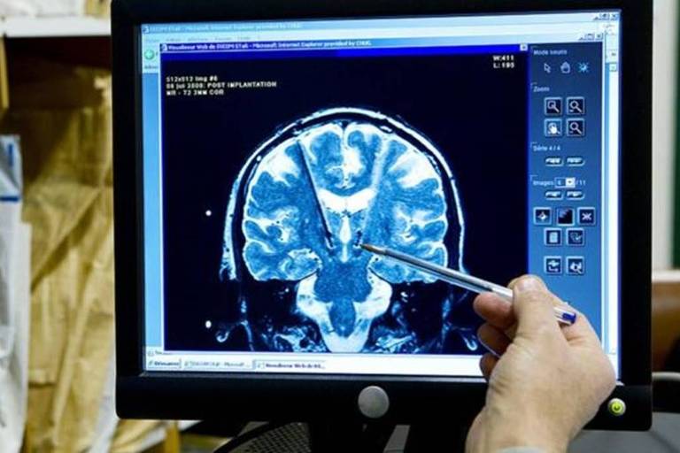 Provavelmente um médico aponta para a imagem de um cérebro em uma tela de computador