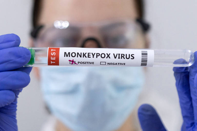 Cidade de SP registra 3 casos de varíola dos macacos em crianças