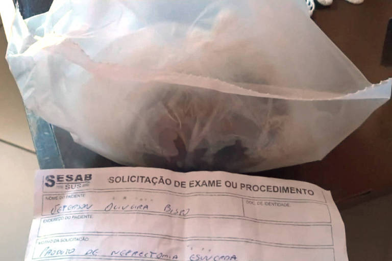 A Secretaria da Saúde da Bahia admitiu erro do hospital Menandro de Faria ao entregar rim de paciente em um saco plástico