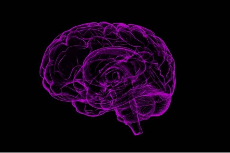 Imagem de raio-X de um cérebro